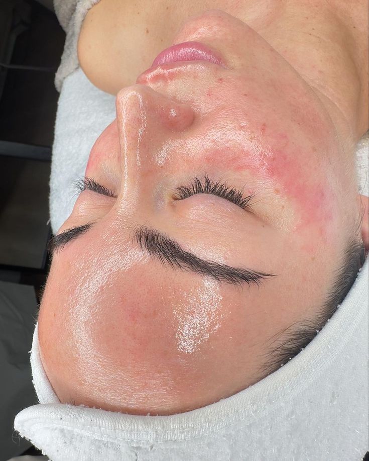Facial 3